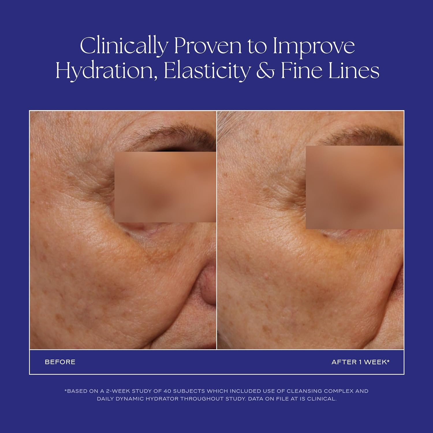 iS CLINICAL Daily Dynamic Hydrator, Hydrating Anti-Aging Face Moisturizer with Hyaluronic Acid, Repairs and Protects Skin, Powered by GeneXC Technology