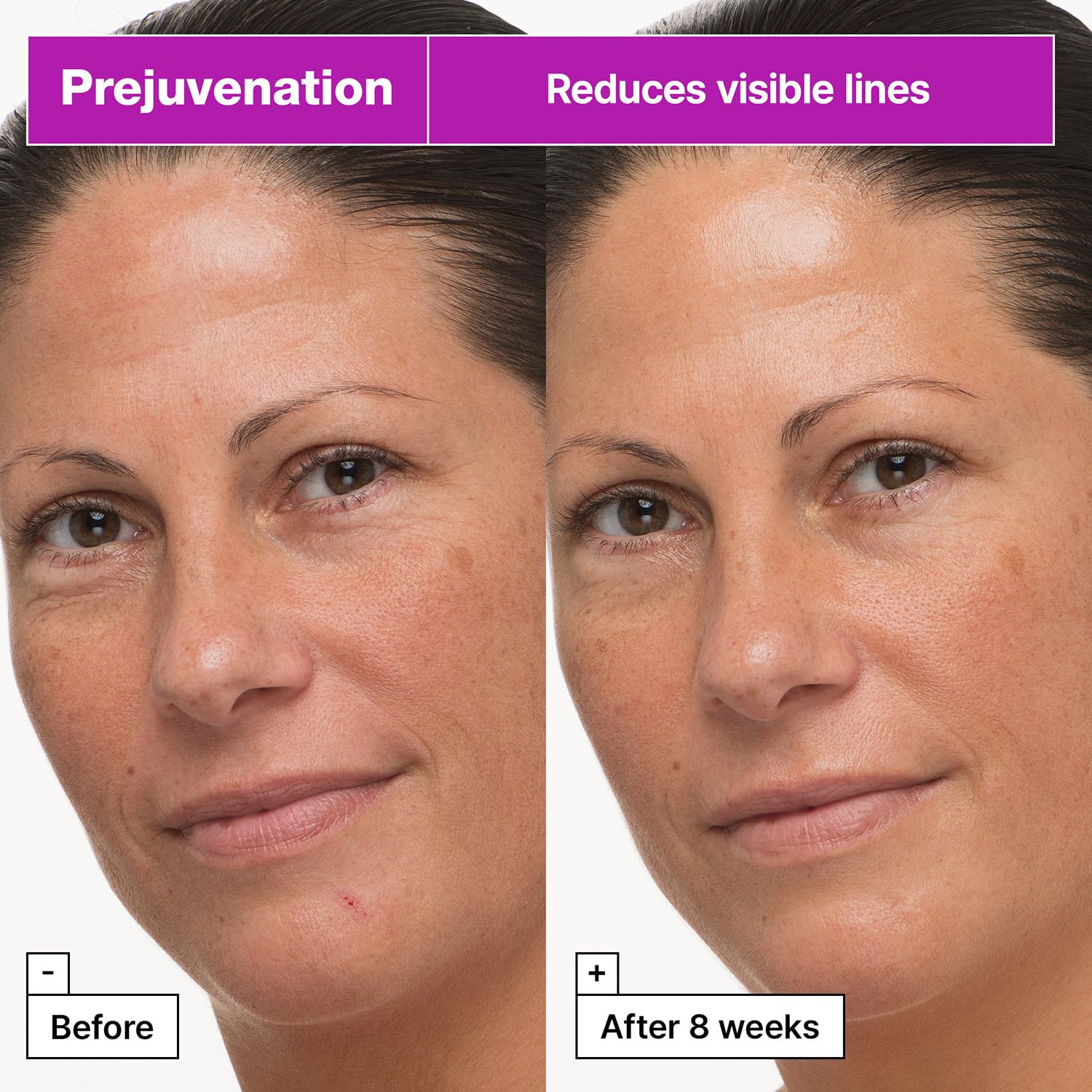 Dr.Jart+ Prejuvenation Firming Bakuchiol Cream with Collagen Peptides | Korean Anti Aging Face Cream | Sensitive Skin Friendly | Korean Skin Care, 1.69 Fl Oz